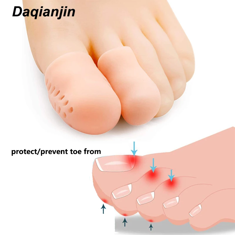 pattanások a lábujjak kezelése között